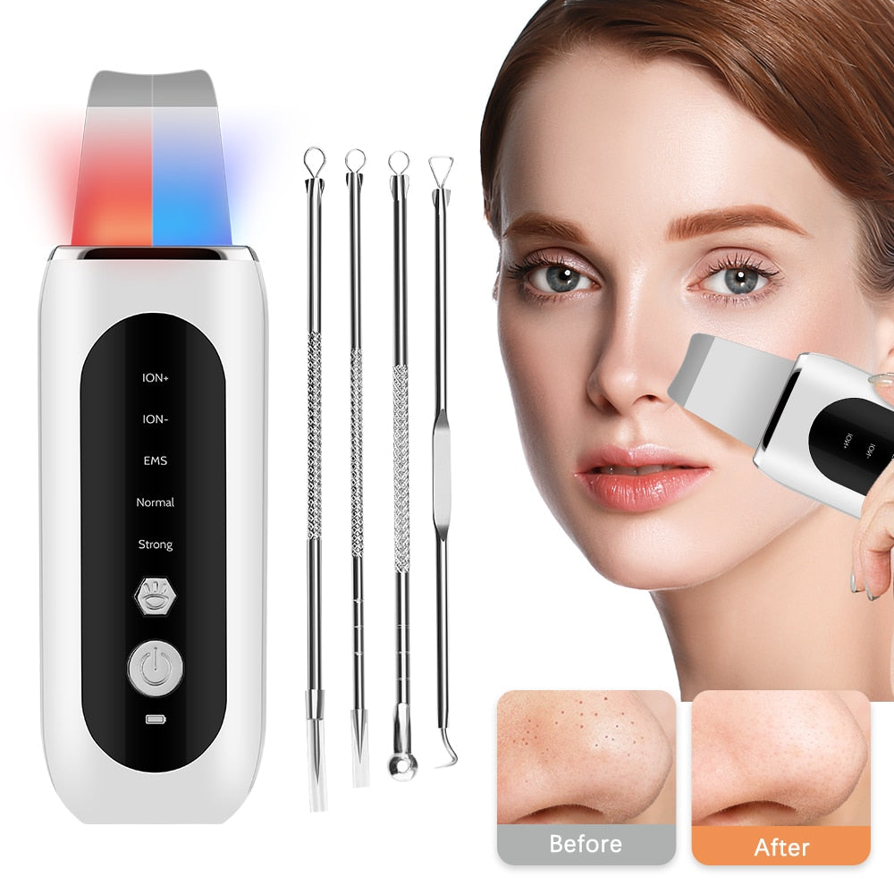 Ultrasonic Face Skin Scrubber - My Store