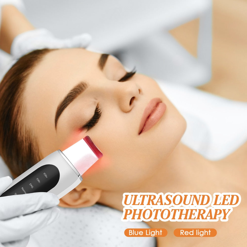 Ultrasonic Face Skin Scrubber - My Store