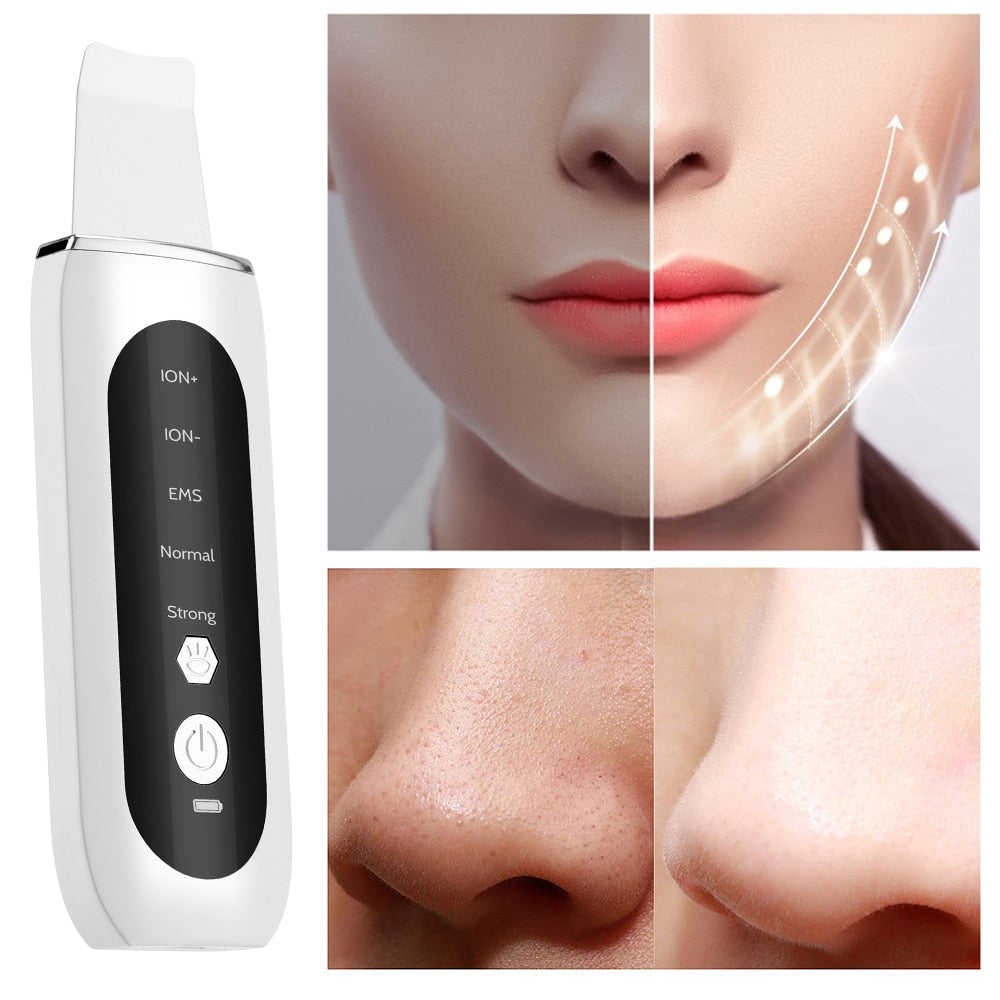 Ultrasonic Face Skin Scrubber - My Store